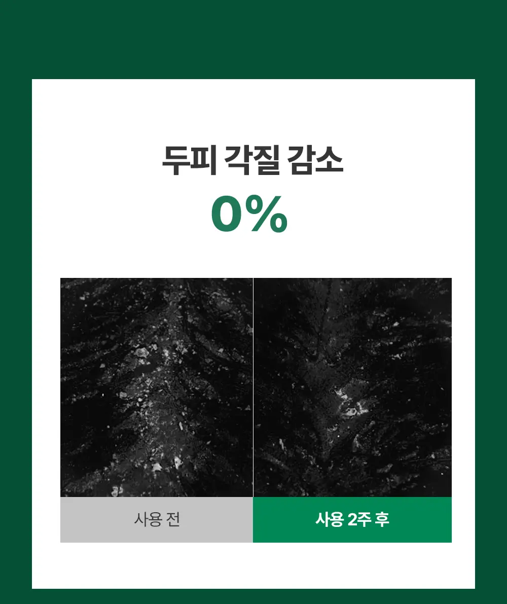 [1등토닉/탈모증상완화] 아로마티카 로즈마리 루트인핸서 100ml (단품/더블기획) 상세페이지 26